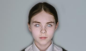 A young girl stares straight ahead with an expressionless look on her face. She has white rings around the iris of her eyes.
