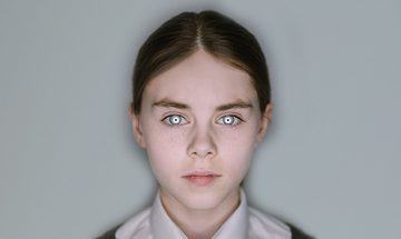 A young girl stares straight ahead with an expressionless look on her face. She has white rings around the iris of her eyes.