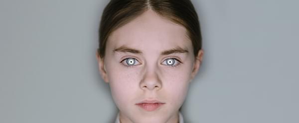 A young girl stares straight ahead with an expressionless look on her face. She has white rings around the iris of her eyes.